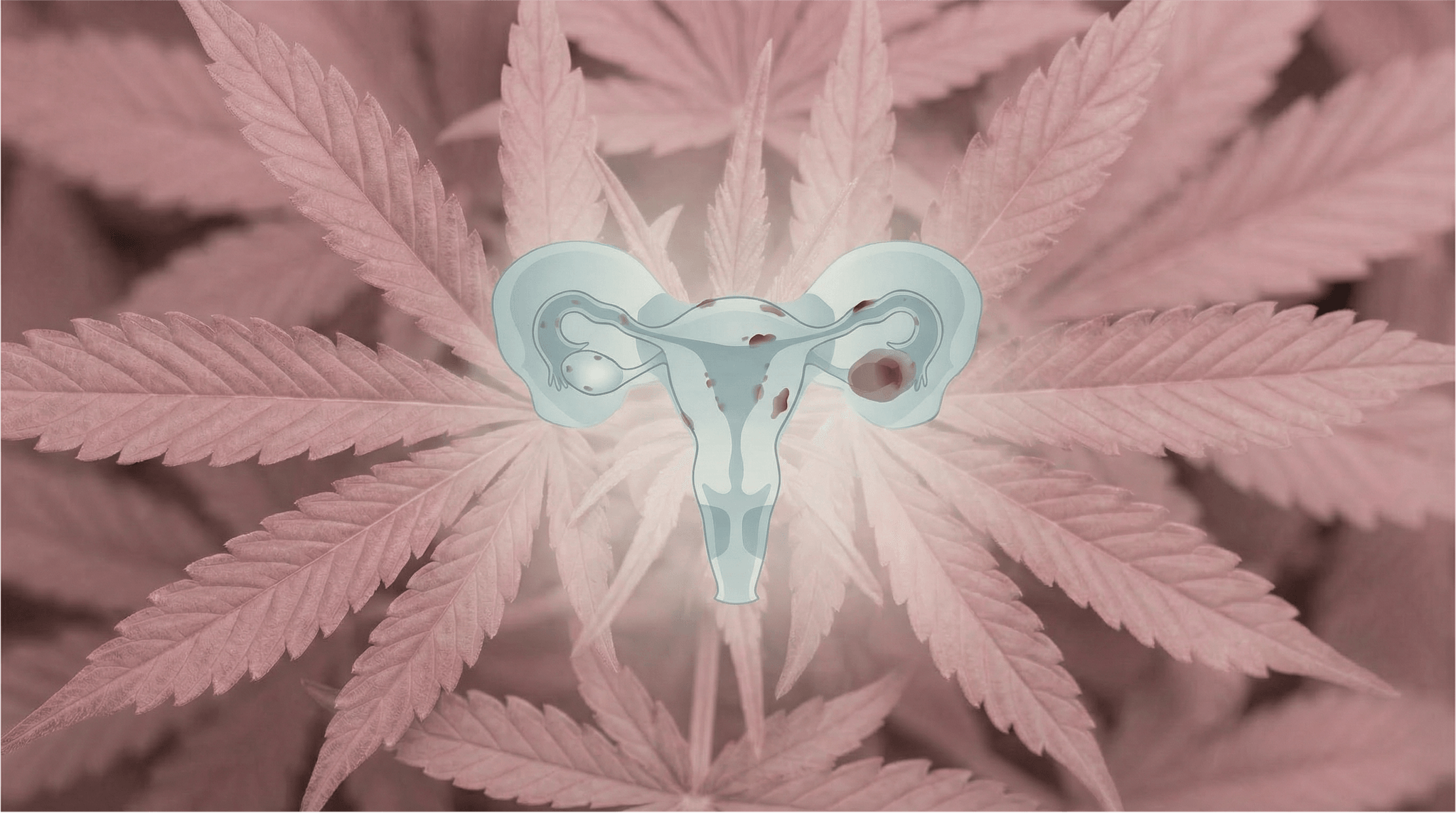 Abstrakte medizinische Illustration der Gebärmutter mit Eileitern und Eierstöcken, auf der dunkelrote Endometriose-Herde sichtbar sind, vor einem Hintergrund aus rosa Cannabisblättern – symbolisch für den Zusammenhang zwischen medizinischem Cannabis und Endometriose.